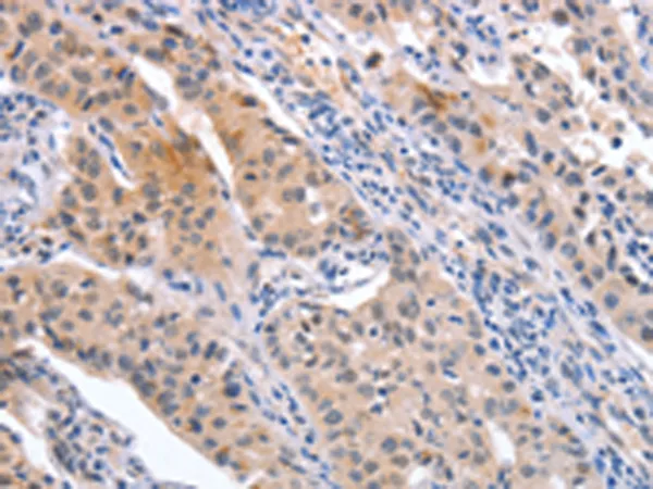 CD59 Rabbit Polyclonal Antibody - image 1
