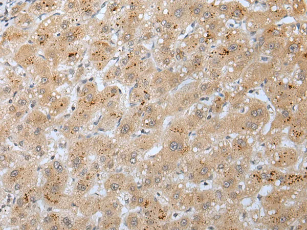 Kv2.1 (KCNB1) Rabbit Polyclonal Antibody - image 1