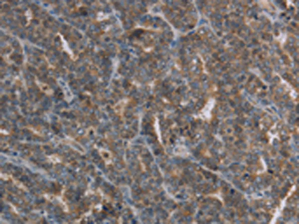 FGF20 Rabbit Polyclonal Antibody - image 1