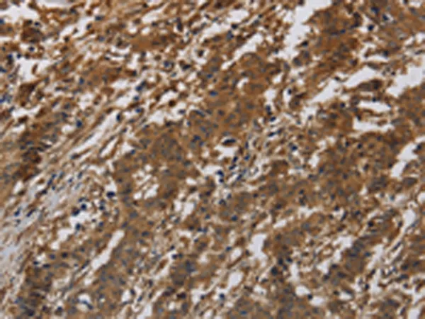 Integrin beta 7 (ITGB7) Rabbit Polyclonal Antibody - image 1