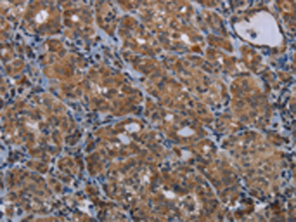 MAGEE1 Rabbit Polyclonal Antibody - image 1