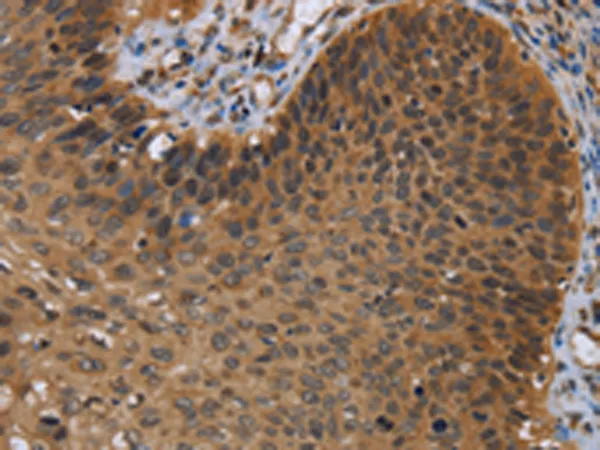 NIRF (UHRF2) Rabbit Polyclonal Antibody - image 1