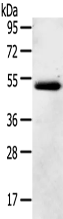 NR2F2 Rabbit Polyclonal Antibody - image 1