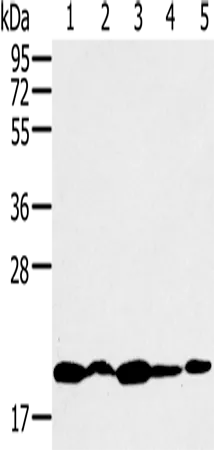 RNF5 Rabbit Polyclonal Antibody - image 1