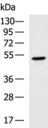 IL1RL2 Rabbit Polyclonal Antibody - image 1