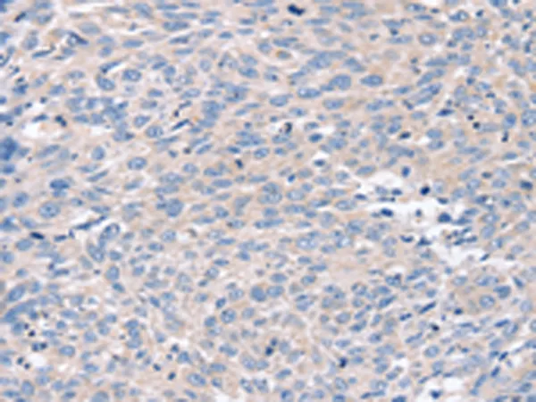 ROR1 Rabbit Polyclonal Antibody - image 1