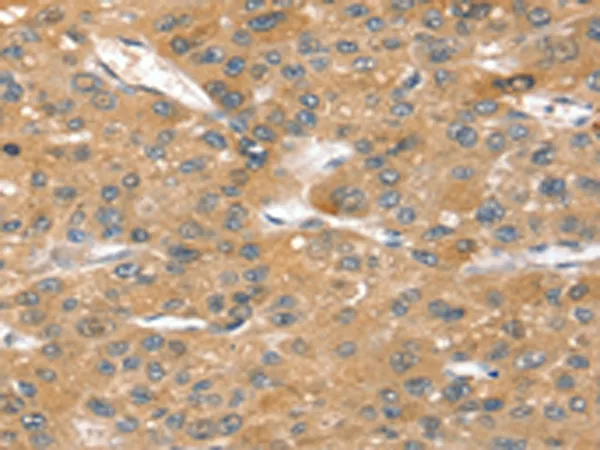 Sortilin (SORT1) Rabbit Polyclonal Antibody - image 1