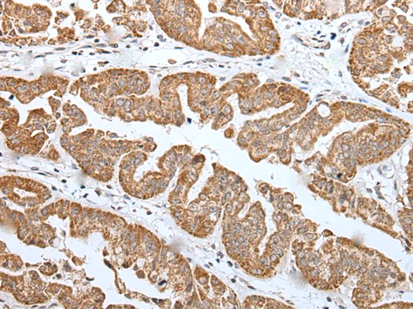 TRIM71 Rabbit Polyclonal Antibody - image 1