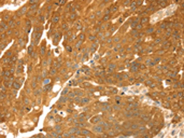 TMEFF2 Rabbit Polyclonal Antibody - image 1
