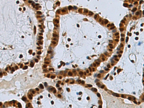 E2 230K (UBE2O) Rabbit Polyclonal Antibody - image 1