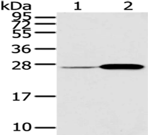 CD79A Rabbit Polyclonal Antibody - image 1