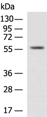 XIAP Rabbit Polyclonal Antibody - image 1
