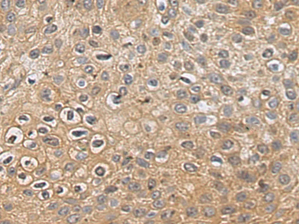 CORO2B Rabbit Polyclonal Antibody - image 1