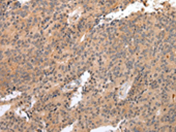 IL18R Beta (IL18RAP) Rabbit Polyclonal Antibody - image 1