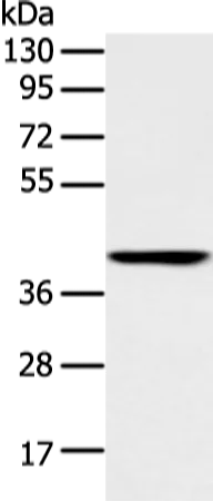 E2F1 Rabbit Polyclonal Antibody - image 1