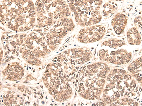MAFB Rabbit Polyclonal Antibody - image 1