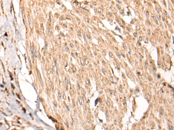 HSF4 Rabbit Polyclonal Antibody - image 1