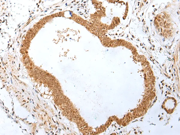 PEG3 Rabbit Polyclonal Antibody - image 1