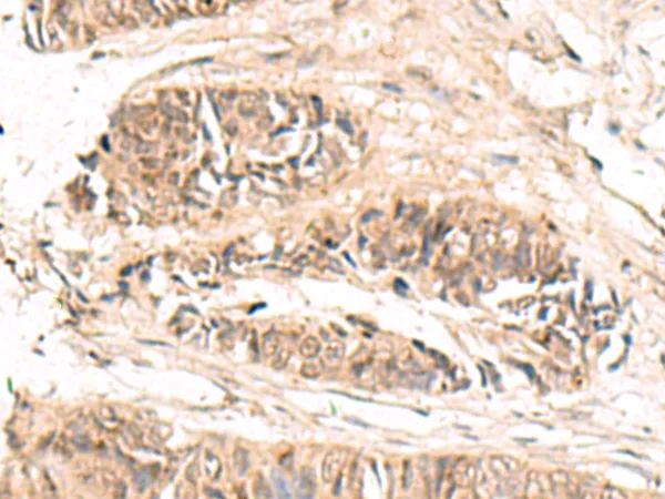 ABCB4 Rabbit Polyclonal Antibody - image 1
