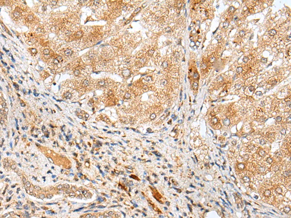 ADAMTS3 Rabbit Polyclonal Antibody - image 1
