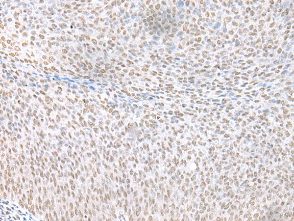 ECT2 Rabbit Polyclonal Antibody - image 1