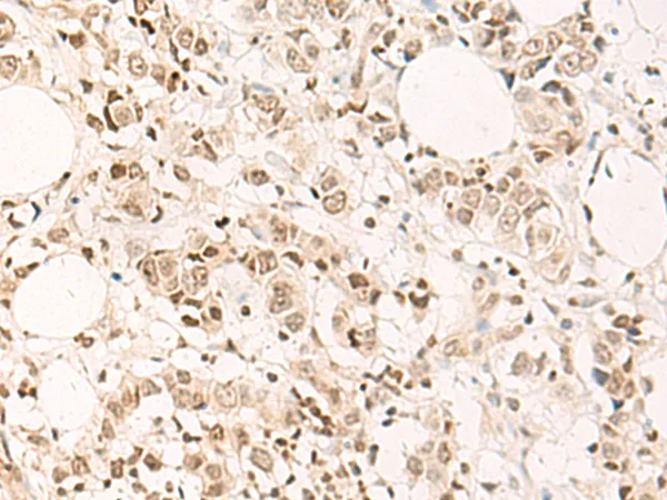 DPPA4 Rabbit Polyclonal Antibody - image 1