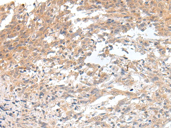 Galanin (GAL) Rabbit Polyclonal Antibody - image 1