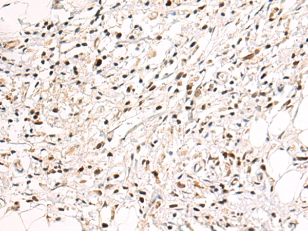 KPNA6 Rabbit Polyclonal Antibody - image 1