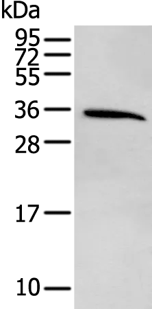 CDC34 Rabbit Polyclonal Antibody - image 1