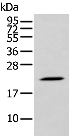 DUSP3 Rabbit Polyclonal Antibody - image 1