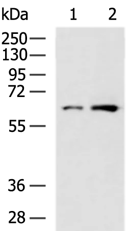 PGM1 Rabbit Polyclonal Antibody - image 1