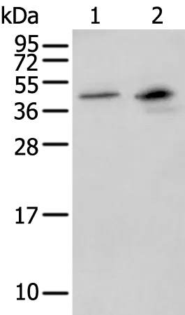 MAGEB1 Rabbit Polyclonal Antibody - image 1
