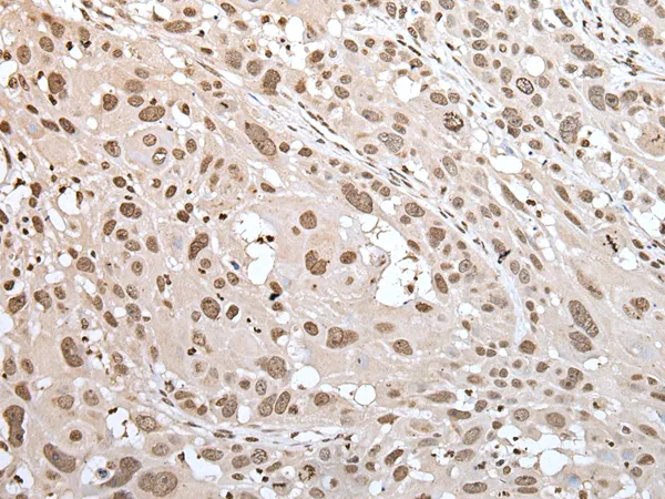 MEF2D Rabbit Polyclonal Antibody - image 1