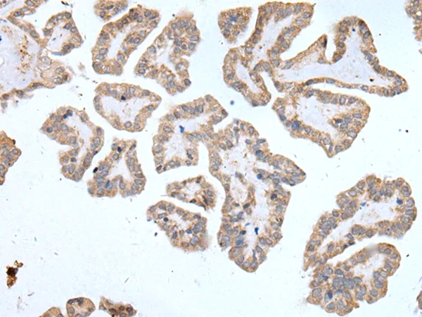 ABCD1 Rabbit Polyclonal Antibody - image 1