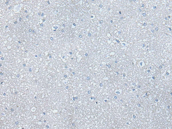 PI 3 Kinase catalytic subunit alpha (PIK3CA) Rabbit Polyclonal Antibody - image 1