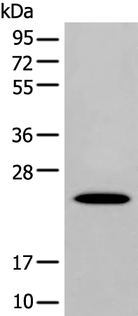 Apolipoprotein D (APOD) Rabbit Polyclonal Antibody - image 1