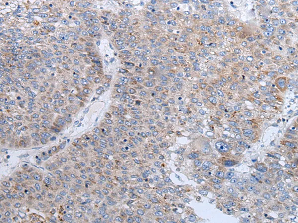 ENPP2 Rabbit Polyclonal Antibody - image 1