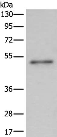BMP5 Rabbit Polyclonal Antibody - image 1