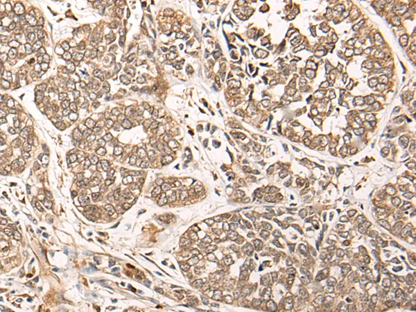 CA5B Rabbit Polyclonal Antibody - image 1