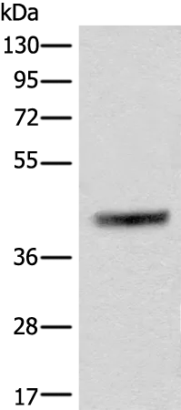 PRKACA Rabbit Polyclonal Antibody - image 1