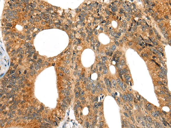 CASS4 Rabbit Polyclonal Antibody - image 1