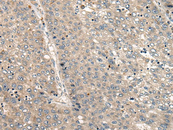 CC2D1A Rabbit Polyclonal Antibody - image 1