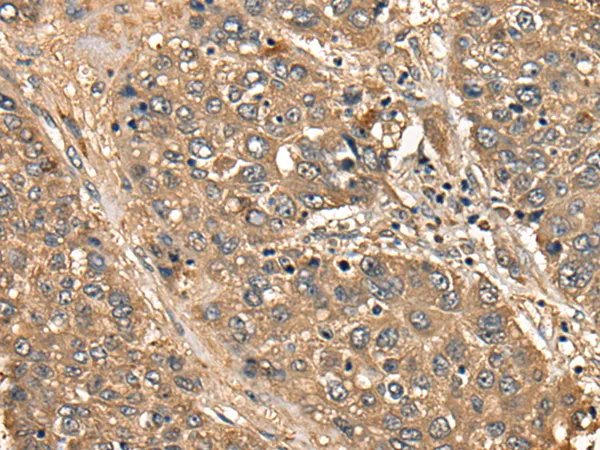 CD1B Rabbit Polyclonal Antibody - image 1