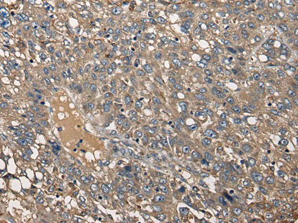 CDC14A Rabbit Polyclonal Antibody - image 1