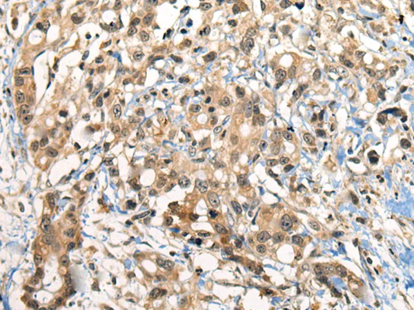 CDC14B Rabbit Polyclonal Antibody - image 1