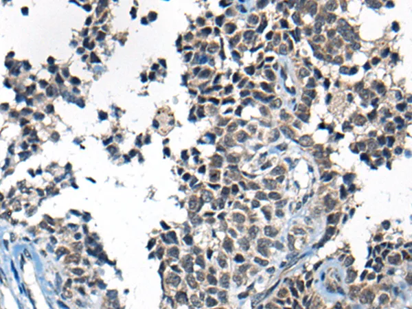 CITED2 Rabbit Polyclonal Antibody - image 1