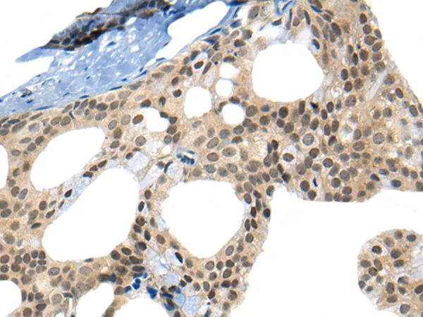 CKS2 Rabbit Polyclonal Antibody - image 1