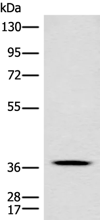 CLN5 Rabbit Polyclonal Antibody - image 1