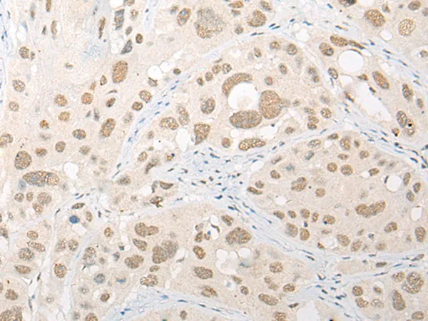 Caspase 10 (CASP10) Rabbit Polyclonal Antibody - image 1
