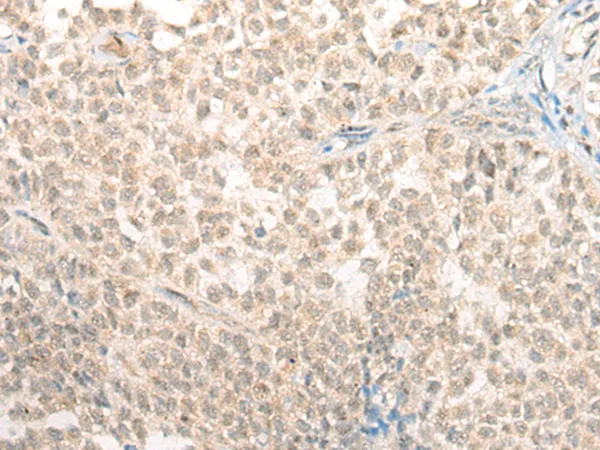 ETS1 Rabbit Polyclonal Antibody - image 1